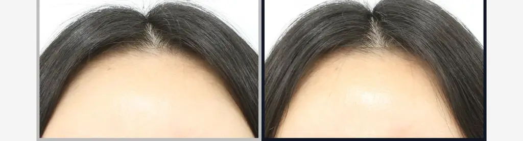 [하늘 PICK/두피겸용쿨링] 에끌무아 더블트러플 탈모케어 퍼퓸 트리트먼트 150ml 상세페이지 18